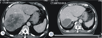 Ablation and therapeutic procedures |HIFU technology main concepts